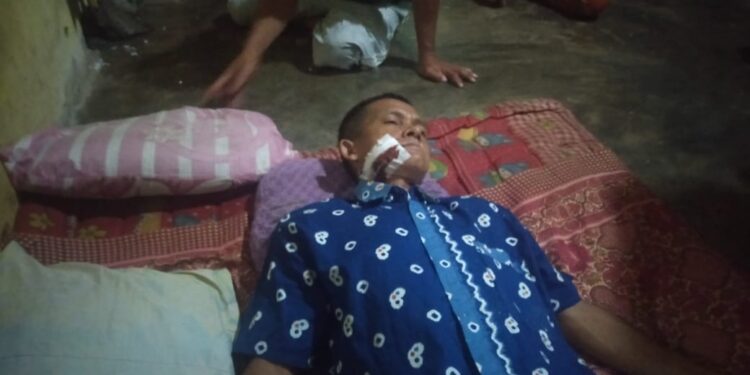 Memprihatinkan Lagi- Lagi Wartawan  Di Aniaya